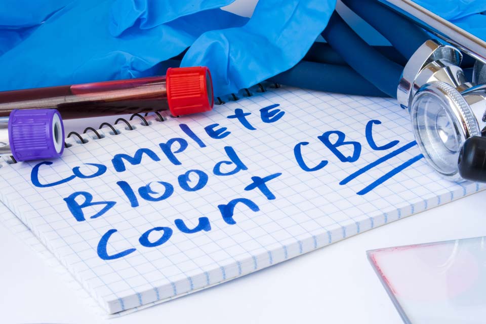 Chronic aplastic anemia causes low counts in all types of blood cells.