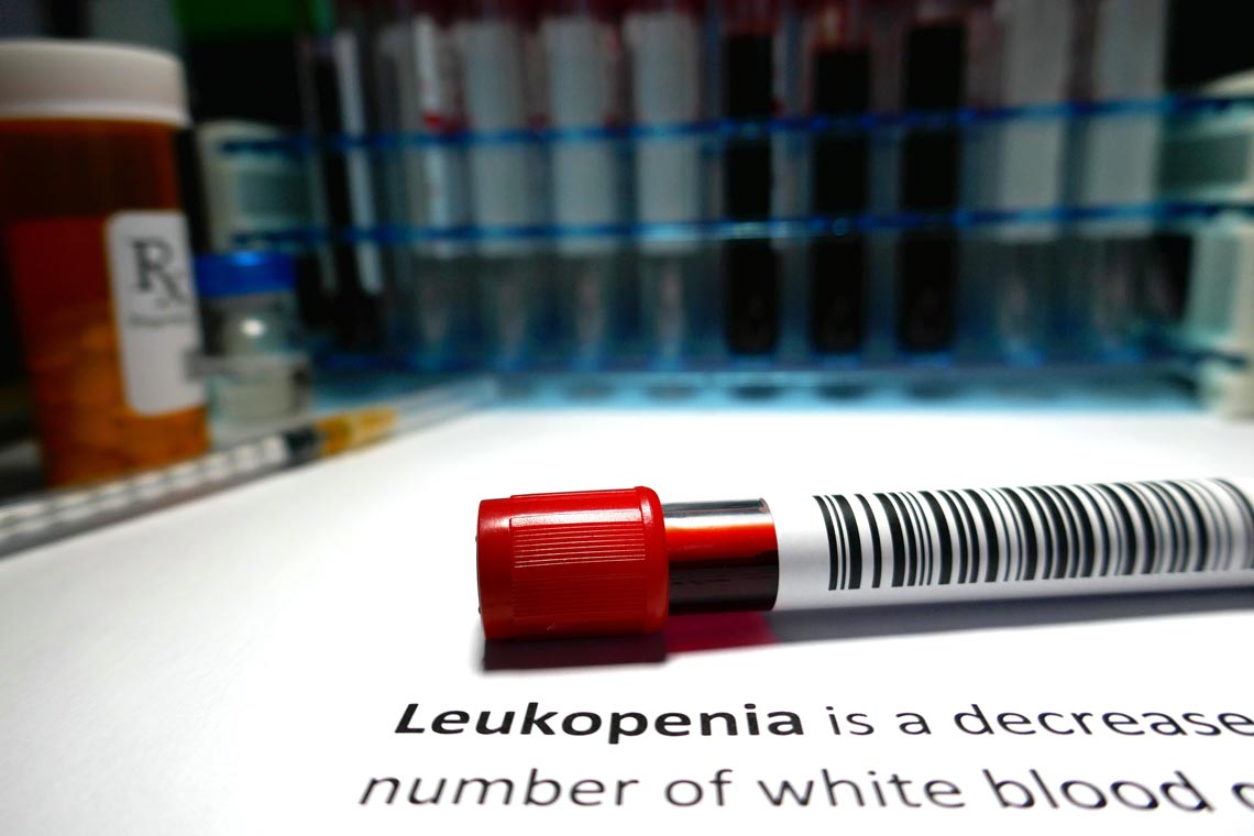 Astragalus Minimizes Leukopenia Astragalus can help counteract leukopenia caused by chemotherapy for colon cancer.