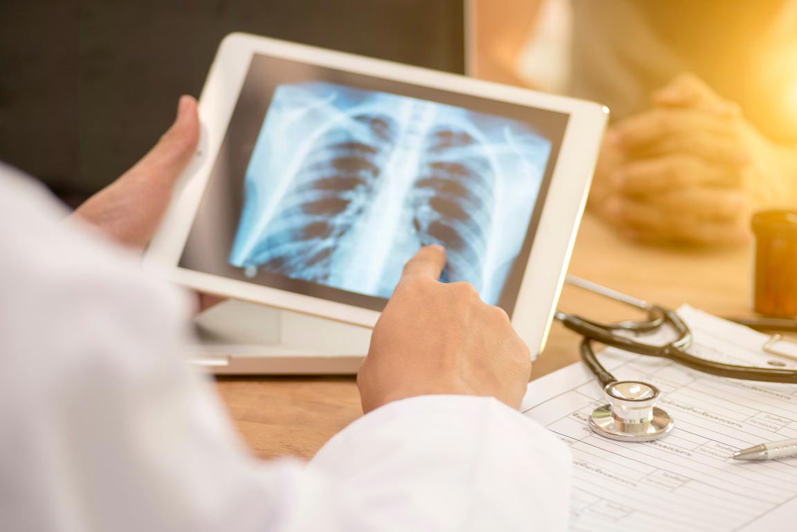 Astragalus Herbal TB Remedy Research suggests astragalus may help tuberculosis drugs work better.